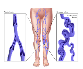 Non-Surgical Treatments